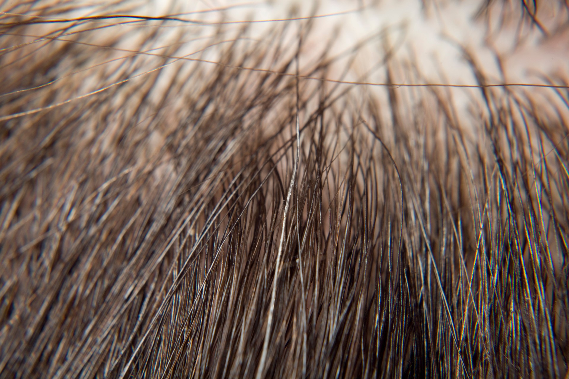 Salp Microblading for men and women in Bangalore India Salp Microblading for men and women in Bangalore India